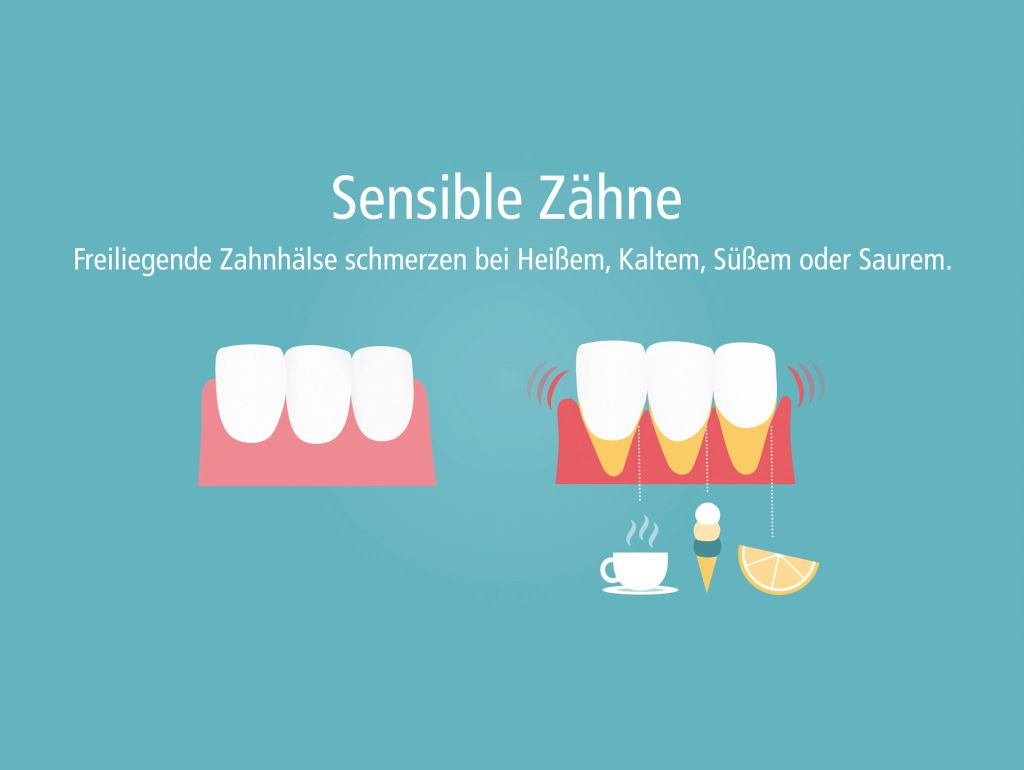 Eine Illustration der Auswirkungen der Reize süß, sauer, heiß und halt auf Zähe