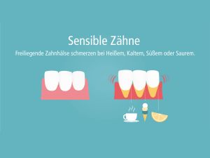 Eine Illustration der Auswirkungen der Reize süß, sauer, heiß und halt auf Zähe